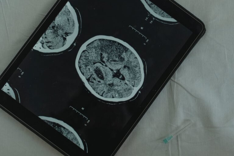 Close-up view of a brain CT scan displayed on a digital tablet with a medical needle beside it.